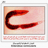   () Enterobius vermicularis